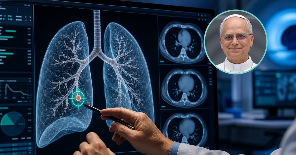 Nódulo pulmonar: por qué se opera cuando mide apenas tres milímetros y qué dicen los especialistas
