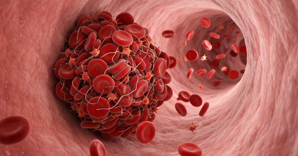 Cuando el cuerpo avisa: cómo reconocer a tiempo un coágulo sanguíneo antes de que sea una emergencia