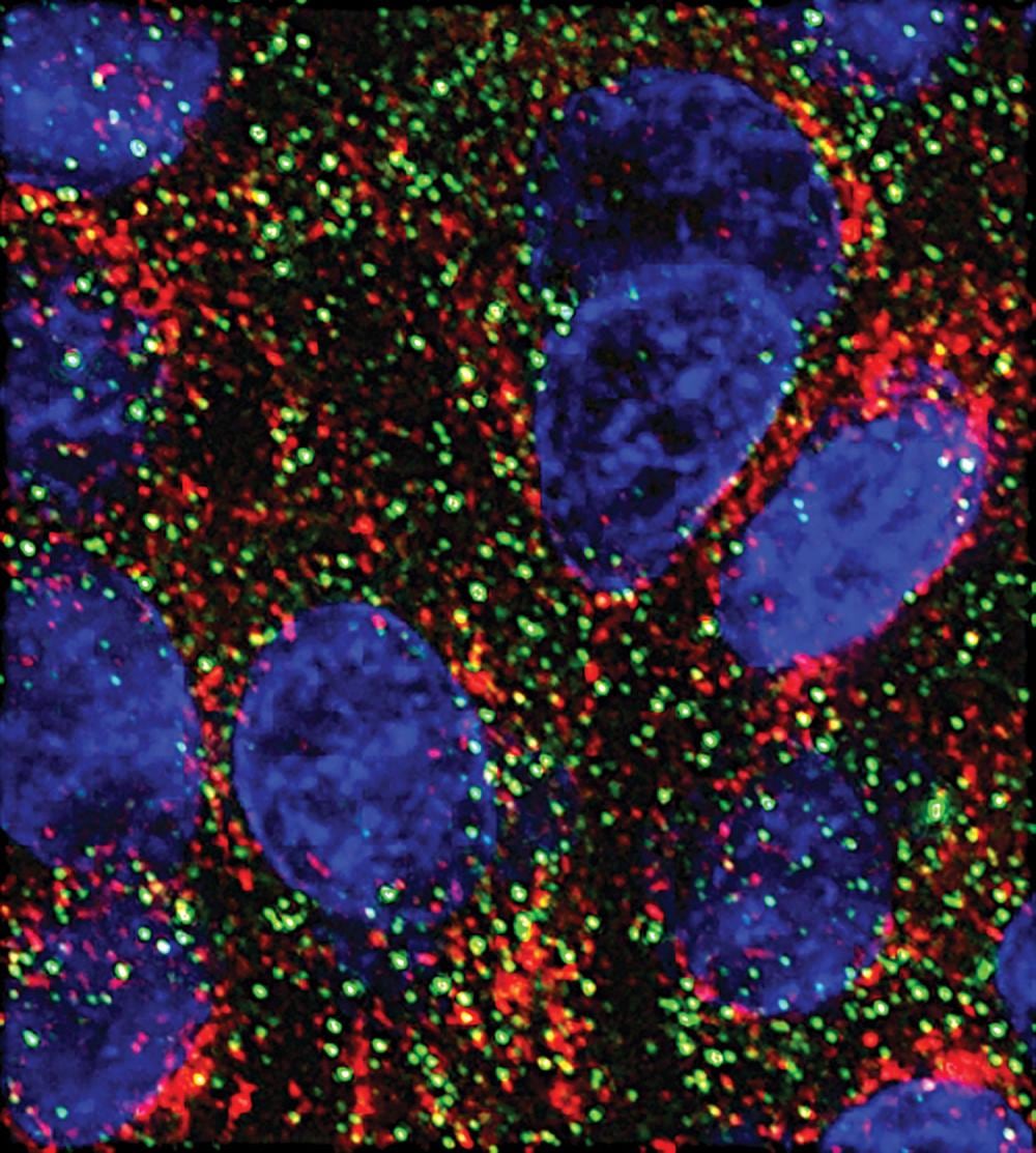 MicroARN reduce la proliferación de células pancreáticas en ensayos de laboratorio